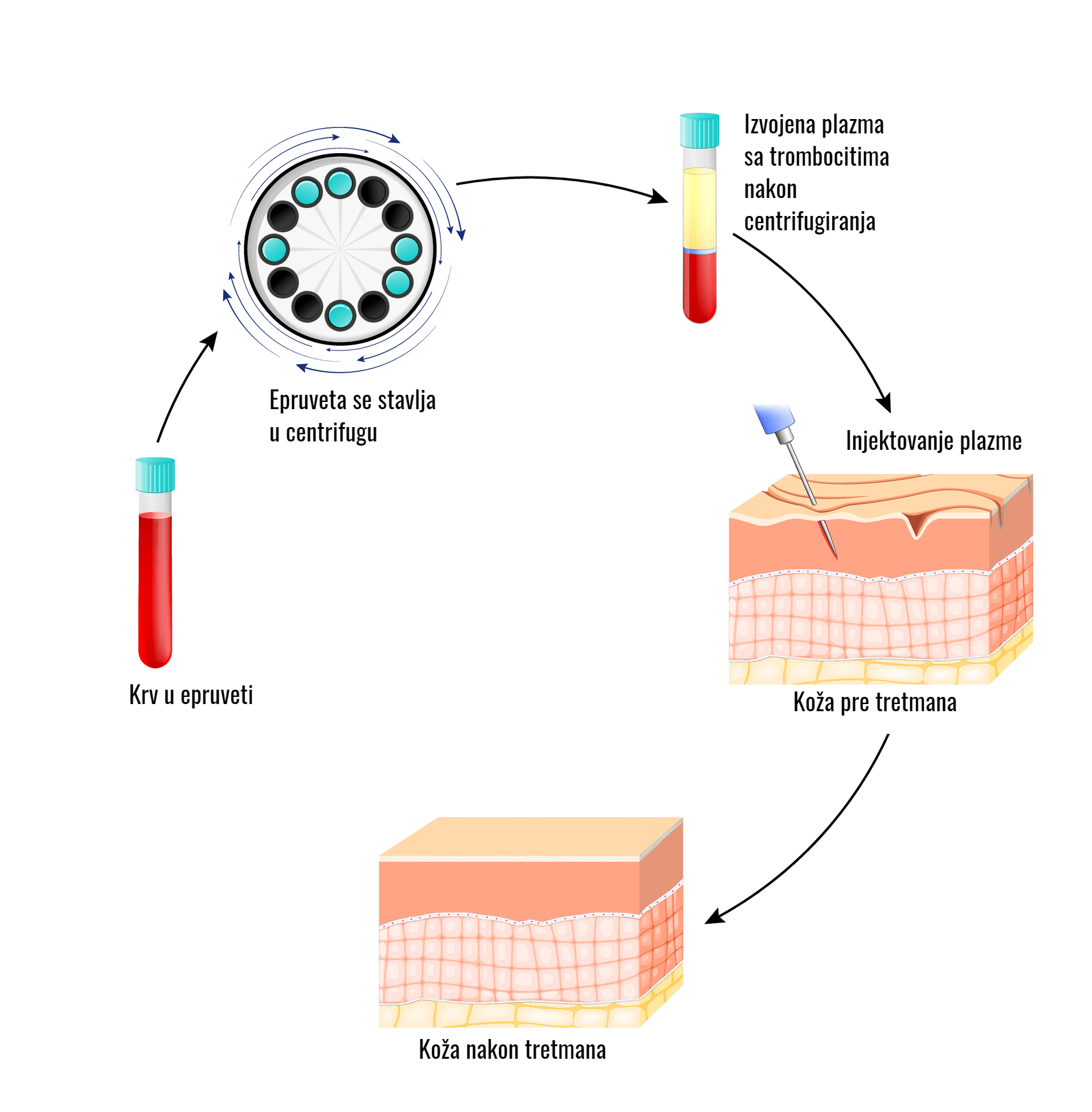 Platelet-rich plasma rejuvenation