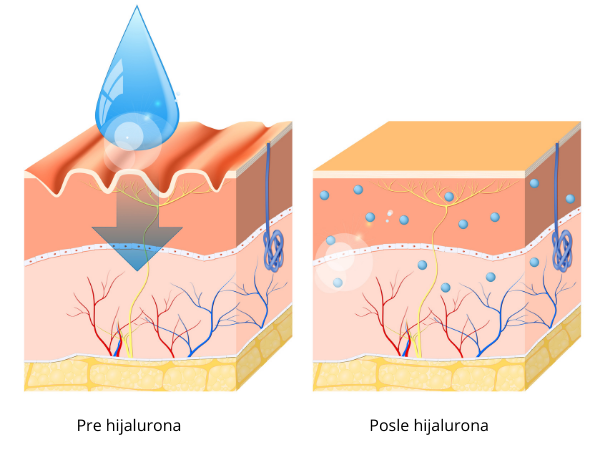 hijaluronska kiselina koža