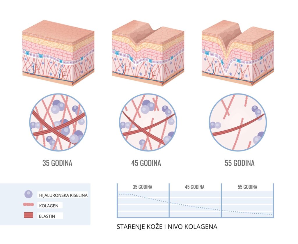 kolagen elastin hijaluronska kiseliina