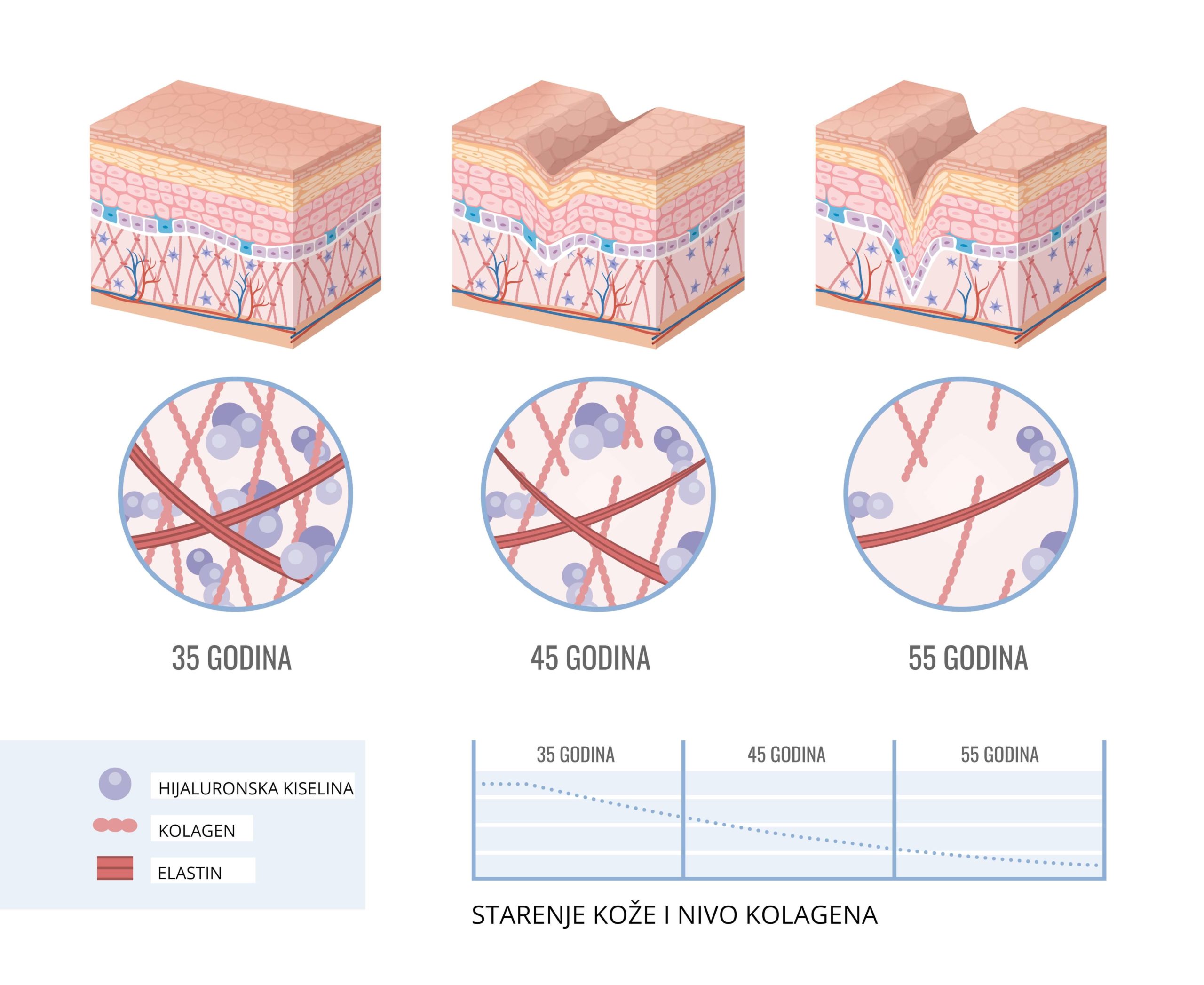 biorevitalizacija hijaluronska kiselina